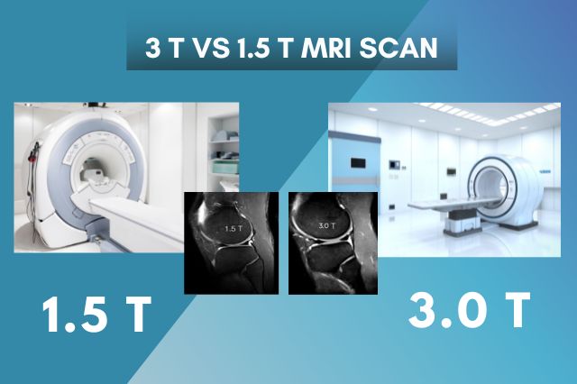 Things That Patient Should Know About The MRI 3 0 T Or 1 5 T Ganesh 